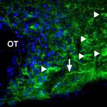 P2X1 Receptor Antibody in Immunohistochemistry (IHC)