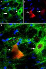 P2X4 Receptor Antibody in Immunohistochemistry (IHC)