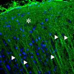 P2X2 Receptor Antibody in Immunohistochemistry (IHC)