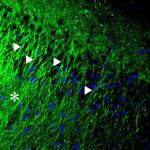 P2X2 Receptor Antibody in Immunohistochemistry (IHC)