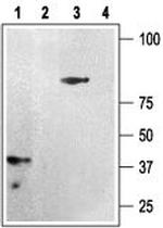 P2Y12 Receptor Antibody in Western Blot (WB)