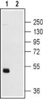 P2Y12 Receptor Antibody in Western Blot (WB)