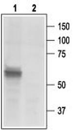 P2X3 Receptor Antibody in Western Blot (WB)