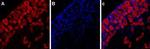 P2X3 Receptor Antibody in Immunohistochemistry (IHC)