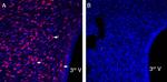 P2X3 Antibody in Immunohistochemistry (Frozen) (IHC (F))