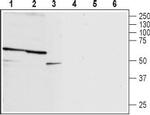 P2X2 Receptor (extracellular) Antibody in Western Blot (WB)