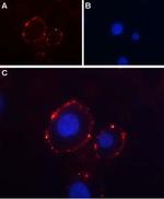 P2X3 Receptor (extracellular) Antibody in Immunocytochemistry (ICC/IF)