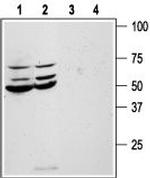 PAR1 (F2R) (extracellular) Antibody in Western Blot (WB)