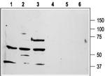 PAR1 (F2R) (extracellular) Antibody in Western Blot (WB)