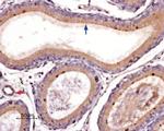 PAR4 (F2RL3) (extracellular) Antibody in Immunohistochemistry (Paraffin) (IHC (P))