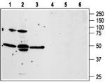 PAR4 (F2RL3) (extracellular) Antibody in Western Blot (WB)