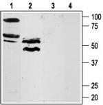 PAR4 (F2RL3) (extracellular) Antibody in Western Blot (WB)