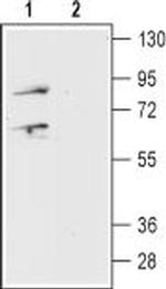 Prokineticin Receptor 1 (extracellular) Antibody in Western Blot (WB)