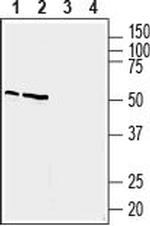 Prostaglandin E Receptor EP4 (PTGER4) Antibody in Western Blot (WB)