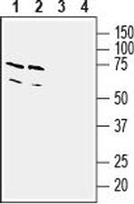 Thromboxane A2 Receptor Antibody in Western Blot (WB)