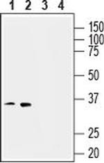 Thromboxane A2 Receptor Antibody in Western Blot (WB)