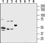 P2Y2 Receptor (extracellular) Antibody in Western Blot (WB)