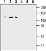 SAP-97/DLG1 Antibody in Western Blot (WB)