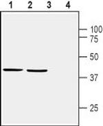 Homer1 Antibody in Western Blot (WB)