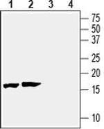 Beta-Synuclein Antibody in Western Blot (WB)