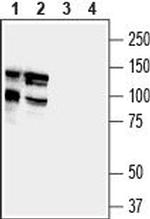 DLGAP1/GKAP Antibody in Western Blot (WB)