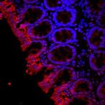 Aquaporin 3 Antibody in Immunohistochemistry (Paraffin) (IHC (P))