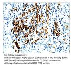 Aquaporin 1 Antibody in Immunohistochemistry (IHC)