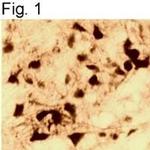 Androgen Receptor Antibody in Immunohistochemistry (IHC)