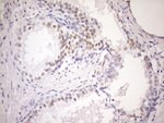 AR Antibody in Immunohistochemistry (Paraffin) (IHC (P))