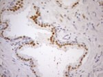 AR Antibody in Immunohistochemistry (Paraffin) (IHC (P))