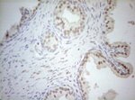 AR Antibody in Immunohistochemistry (Paraffin) (IHC (P))