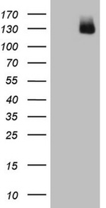 AR Antibody in Western Blot (WB)