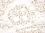 ARA70 Antibody in Immunohistochemistry (IHC)