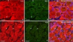 IL-6 Antibody in Immunohistochemistry (IHC)