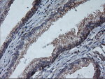 ARCN1 Antibody in Immunohistochemistry (Paraffin) (IHC (P))