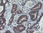 ARCN1 Antibody in Immunohistochemistry (Paraffin) (IHC (P))