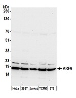 ARF6/ADP Ribosylation Factor 6 Antibody in Western Blot (WB)