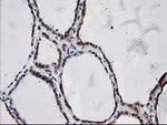 ARFGAP1 Antibody in Immunohistochemistry (Paraffin) (IHC (P))