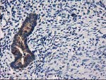 ARFGAP1 Antibody in Immunohistochemistry (Paraffin) (IHC (P))