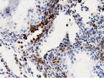 ARHGAP25 Antibody in Immunohistochemistry (Paraffin) (IHC (P))