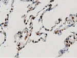 ARHGAP25 Antibody in Immunohistochemistry (Paraffin) (IHC (P))