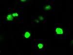 ARHGDIA Antibody in Immunocytochemistry (ICC/IF)