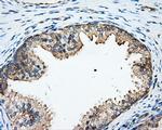 ARHGDIA Antibody in Immunohistochemistry (Paraffin) (IHC (P))