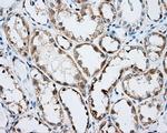 ARHGDIA Antibody in Immunohistochemistry (Paraffin) (IHC (P))