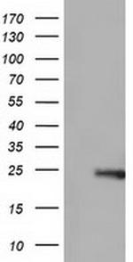 ARHGDIA Antibody in Western Blot (WB)