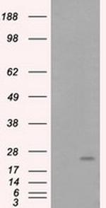 ARHGDIA Antibody in Western Blot (WB)