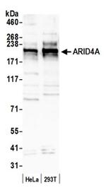 ARID4A Antibody in Western Blot (WB)