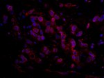 ARID4B Antibody in Immunohistochemistry (IHC)