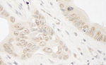 ARIP4 Antibody in Immunohistochemistry (IHC)