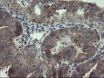 ARL2BP Antibody in Immunohistochemistry (Paraffin) (IHC (P))